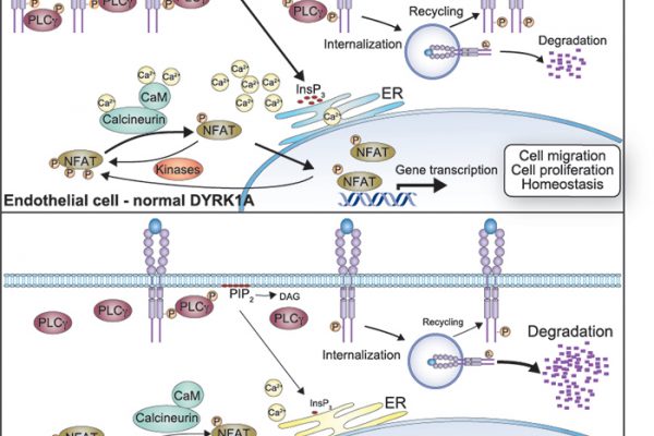 DYRK1A role in angiogenesis